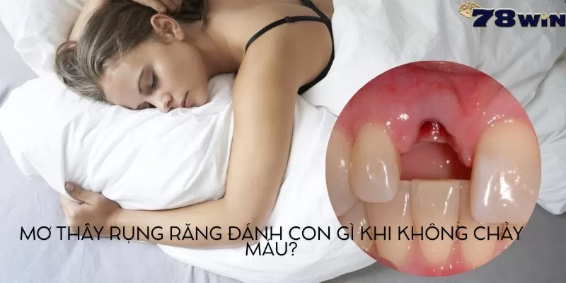 Nằm Mơ Thấy Rụng Răng Đánh Con Gì? 78Win Giải Mã Chi Tiết Nhất 3 Mơ thấy rụng răng đánh con gì khi không chảy máu?